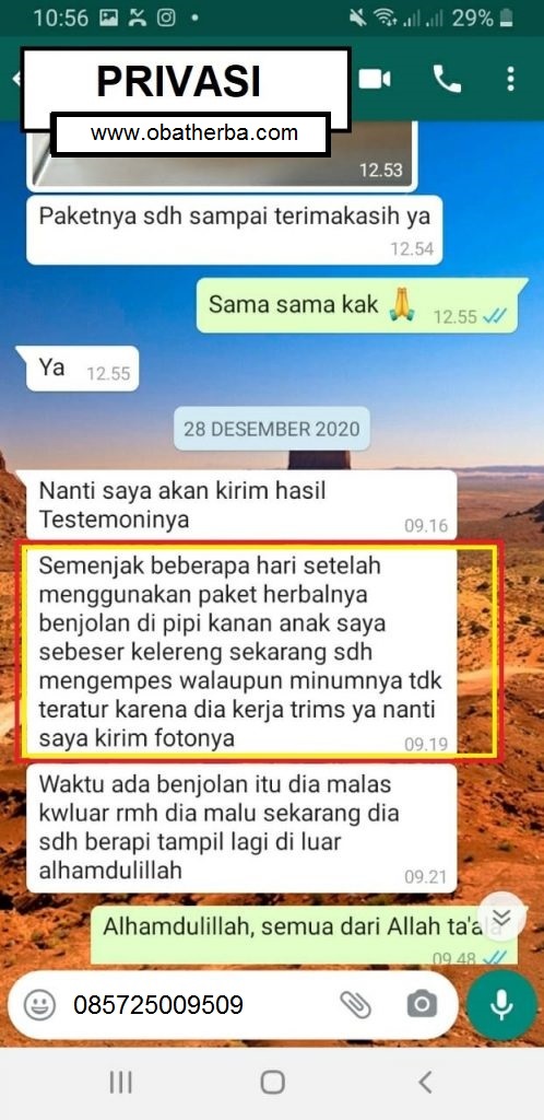 obat herbal benjolan alami