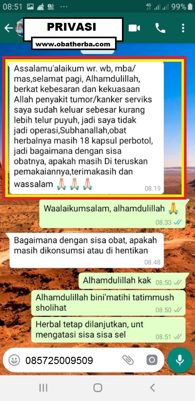 testimoni kanker serviks