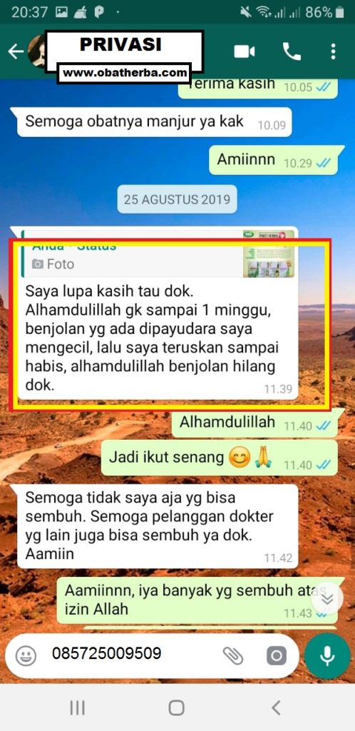 testimoni sembuh dari kanker payudara